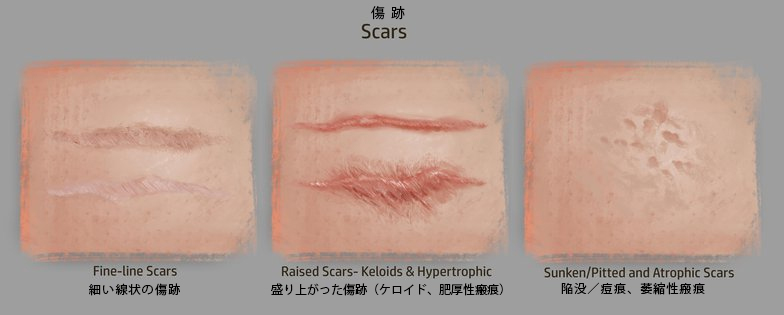 痣 銃創 リアルな傷跡の描き方 3dtotal 日本語オフィシャルサイト Part 2